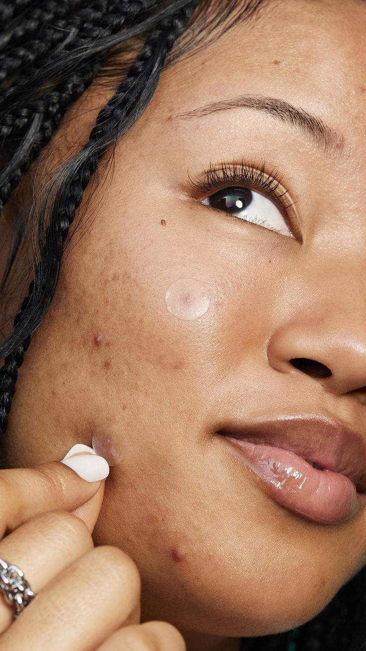 Cosrx Pimple Master Patch