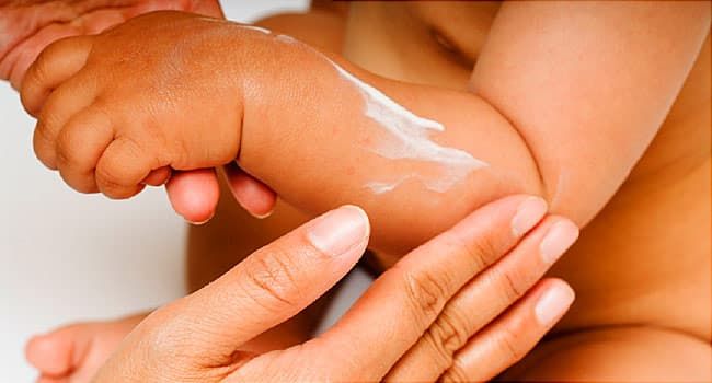 Aquaphor Baby Healing Ointment (14 Oz)