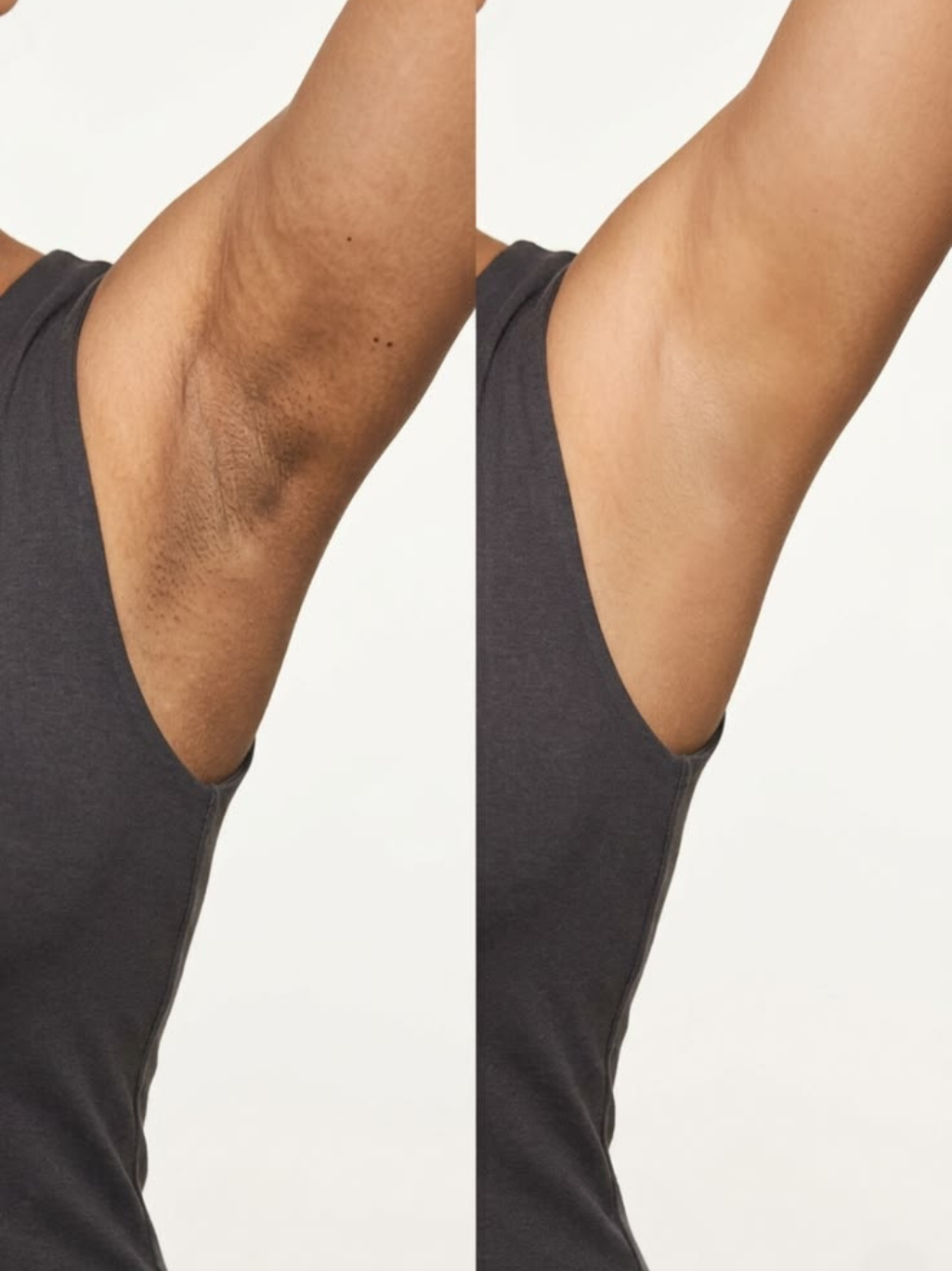 Dove Advanced Care Even Tone + Niacinamide Spray