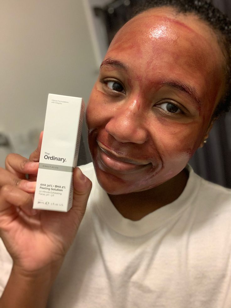 The Ordinary AHA 30% + BHA 2% Peeling Solution 30ml
