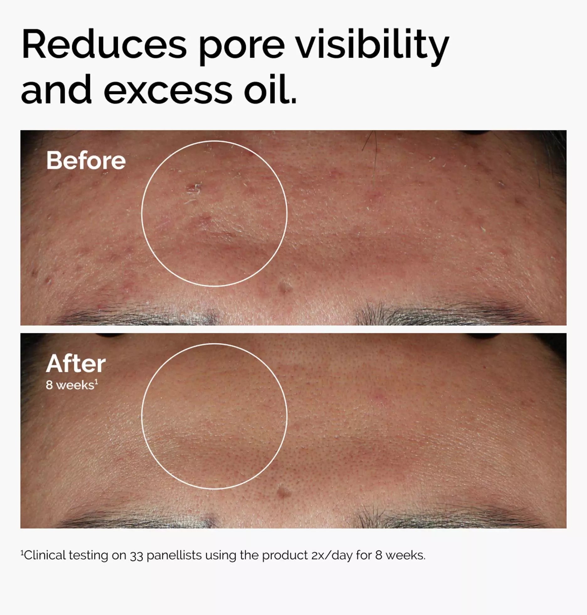 The Ordinary Niacinamide 10% + Zinc 1% 60ml
